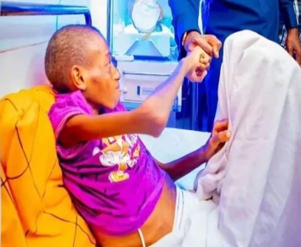 Boy with missing intestine after surgery